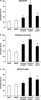 Inhibition of Fatty Acid Synthesis Aggravates Brain Injury, Reduces Blood-Brain Barrier Integrity and Impairs Neurological Recovery in a Murine Stroke Model